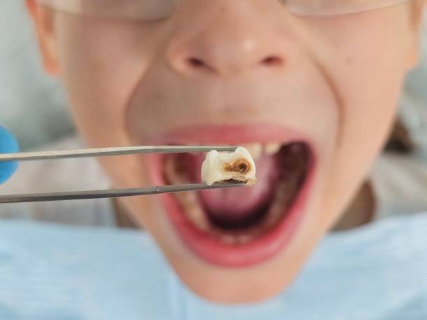 Best Emergency Treatment for Oral Infections in Waawa, HI